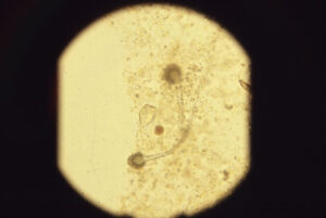 Aspergillus spores